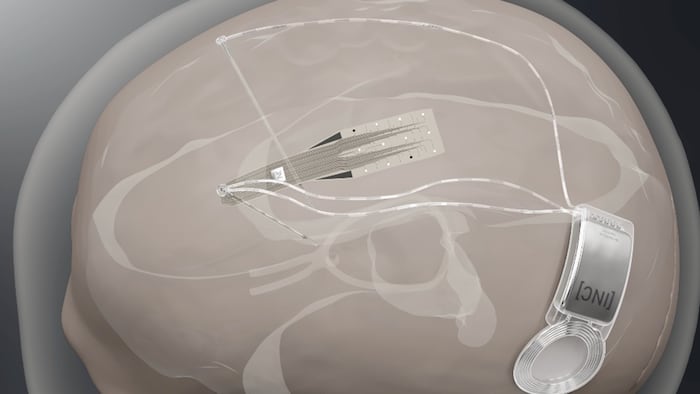 InBrain’s brain-computer interfaces
