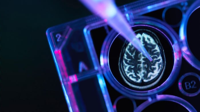 Brain research