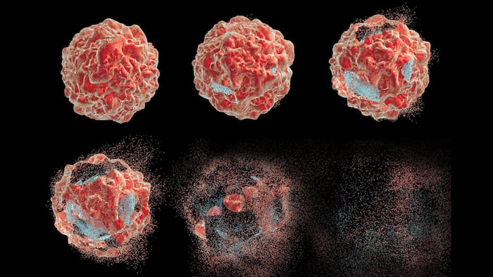 Series of images showing different stages of destruction of a tumor cell. 3D illustration. Can be used to illustrate effect of drugs, medicines, microbes, nanoparticles