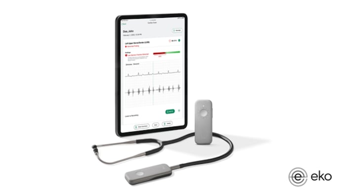 Eko Stethoscope Results