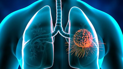 Zai Lab’s DLL3 ADC Emerges As New Force In ES-SCLC Race