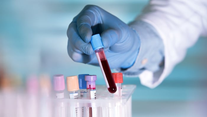Crovalimab received global first approval in China and awaits approval decisions in the US, Europe and Japan.